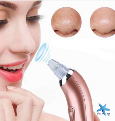 Вакуумный аппарат для чистки пор Beauty Skin Care XN-8030 · Прибор для очищения пор · Аппаратная чистка лица