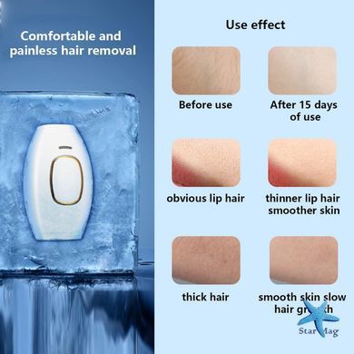 Портативный женский домашний фотоэпилятор для тела IPL Hair Removal Device для всех типов волос ∙ Женский лазерный эпилятор для всего тела IPL Hair Removal