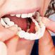 Съемные виниры для зубов Snap On Smile на 2 челюсти &bull; Накладные виниры на верхнюю и нижнюю челюсть для красивой улыбки