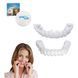 Съемные виниры для зубов Snap On Smile на 2 челюсти &bull; Накладные виниры на верхнюю и нижнюю челюсть для красивой улыбки